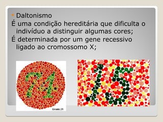  Daltonismo
É uma condição hereditária que dificulta o
indivíduo a distinguir algumas cores;
É determinada por um gene recessivo
ligado ao cromossomo X;
 