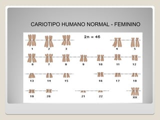 CARIOTIPO HUMANO NORMAL - FEMININO
 