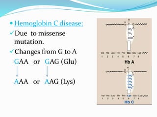  Hemoglobin C disease:
Due to missense
mutation.
Changes from G to A
GAA or GAG (Glu)
AAA or AAG (Lys)
 