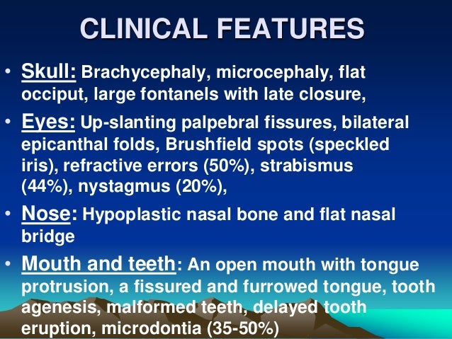 Flat Nasal Bridge And Epicanthal Folds / Pediatric ...