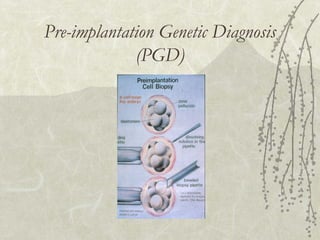 Pre-implantation Genetic Diagnosis
(PGD)

 