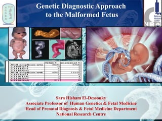 Genetic Diagnostic Approach
to the Malformed Fetus
Sara Hisham El-Dessouky
Associate Professor of Human Genetics & Fetal Medicine
Head of Prenatal Diagnosis & Fetal Medicine Department
National Research Centre
 