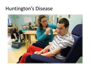 Huntington’s Disease
 