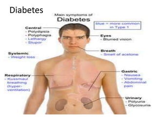 Diabetes
 