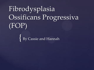 Fibrodysplasia
Ossificans Progressiva
(FOP)
   { By Cassie and Hannah
 