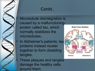 Contd..
• Microtubule disintegration is
caused by a malfunctioning
protein called tau, which
normally stabilizes the
microtubules.
• In Alzheimer's patients, tau
proteins instead cluster
together to form disabling
tangles.
• These plaques and tangles
damage the healthy cells
around them.
 