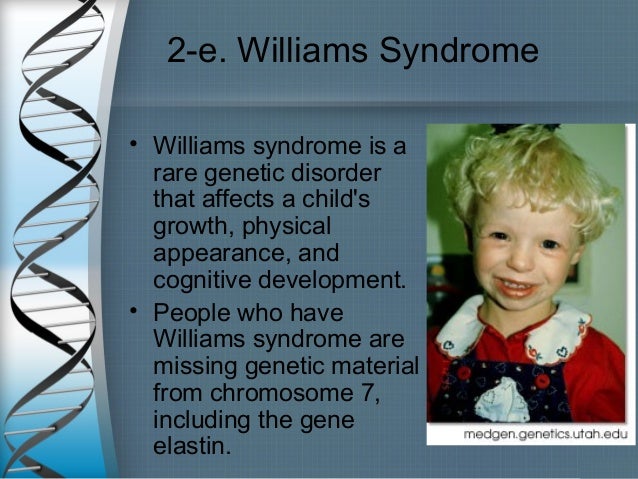 missing chromosome disease