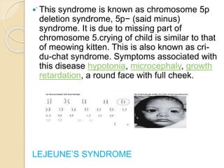 c
 This syndrome is known as chromosome 5p
deletion syndrome, 5p− (said minus)
syndrome. It is due to missing part of
chromosome 5.crying of child is similar to that
of meowing kitten. This is also known as cri-
du-chat syndrome. Symptoms associated with
this disease hypotonia, microcephaly, growth
retardation, a round face with full cheek.
LEJEUNE’S SYNDROME
 