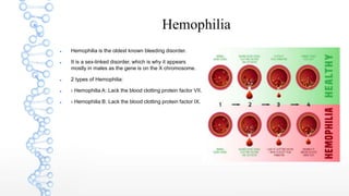Hemophilia
 Hemophilia is the oldest known bleeding disorder.
 It is a sex-linked disorder, which is why it appears
mostly in males as the gene is on the X chromosome.
 2 types of Hemophilia:
 › Hemophilia A: Lack the blood clotting protein factor VII.
 › Hemophilia B: Lack the blood clotting protein factor IX.
 