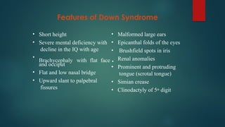 Features of Down Syndrome
•
•
Short height
Severe mental deficiency with
decline in the IQ with age
•
•
•
and occiput
Flat and low nasal bridge
Upward slant to palpebral
fissures
•
•
•
Brachycephaly with flat face •
•
•
•
Malformed large ears
Epicanthal folds of the eyes
Brushfield spots in iris
Renal anomalies
Prominent and protruding
tongue (scrotal tongue)
Simian crease
Clinodactyly of 5th digit
 