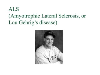 ALS
(Amyotrophic Lateral Sclerosis, or
Lou Gehrig’s disease)
 