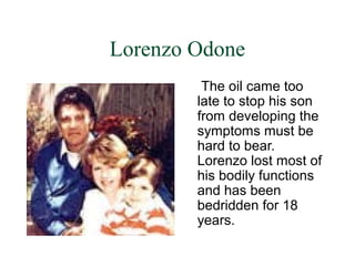 Lorenzo Odone
         The oil came too
        late to stop his son
        from developing the
        symptoms must be
        hard to bear.
        Lorenzo lost most of
        his bodily functions
        and has been
        bedridden for 18
        years.
 