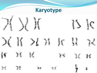 Karyotype
 