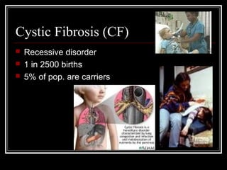 Cystic Fibrosis (CF)




Recessive disorder
1 in 2500 births
5% of pop. are carriers

 