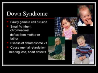 Down Syndrome
Faulty gamete cell division
 Small % inherit
chromosomal
defect from mother or
father
 Excess of chromosome 21
 Cause mental retardation,
hearing loss, heart defects


 