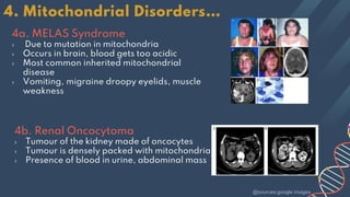 4. Mitochondrial Disorders…
4a. MELAS Syndrome
› Due to mutation in mitochondria
› Occurs in brain, blood gets too acidic
› Most common inherited mitochondrial
disease
› Vomiting, migraine droopy eyelids, muscle
weakness
4b. Renal Oncocytoma
› Tumour of the kidney made of oncocytes
› Tumour is densely packed with mitochondria
› Presence of blood in urine, abdominal mass
@sources:google images
 