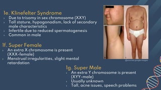 1e. Klinefelter Syndrome
› Due to trisomy in sex chromosome (XXY)
› Tall stature, hypogonadism, lack of secondary
male characteristics
› Infertile due to reduced spermatogenesis
› Common in male
1f. Super Female
› An extra X chromosome is present
(XXX-female)
› Menstrual irregularities, slight mental
retardation
1g. Super Male
› An extra Y chromosome is present
(XYY-male)
› Usually unknown
› Tall, acne issues, speech problems
@sources:google images
 
