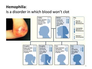 Hemophilia:
Is a disorder in which blood won’t clot
36
 