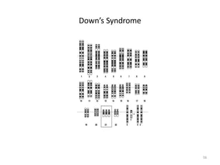Down’s Syndrome
56
 