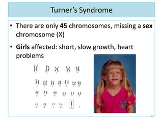 Turner’s Syndrome
• There are only 45 chromosomes, missing a sex
chromosome (X)
• Girls affected: short, slow growth, heart
problems
60
 