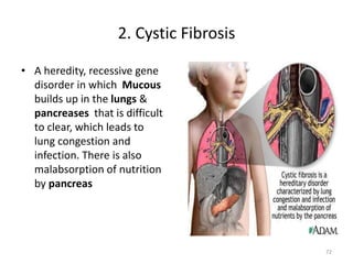2. Cystic Fibrosis
• A heredity, recessive gene
disorder in which Mucous
builds up in the lungs &
pancreases that is difficult
to clear, which leads to
lung congestion and
infection. There is also
malabsorption of nutrition
by pancreas
72
 