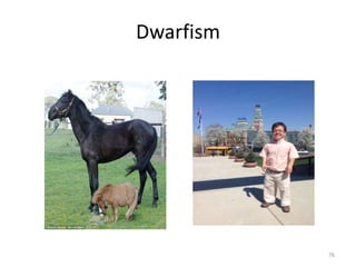 Dwarfism
76
 