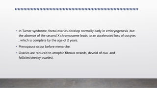 • In Turner syndrome, foetal ovaries develop normally early in embryogenesis ,but
the absence of the second X chromosome leads to an accelerated loss of oocytes
, which is complete by the age of 2 years.
• Menopause occur before menarche.
• Ovaries are reduced to atrophic fibrous strands, devoid of ova and
follicles(streaky ovaries).
 