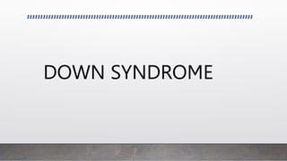DOWN SYNDROME
 