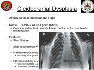 Cleidocranial Dysplasia
• Pelvis narrow, hips may be unstable at birth
• Coxa Vara + Trendelenburg Gait
• Increased incide...