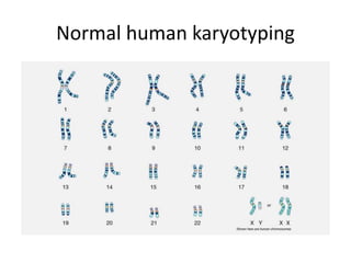 Normal human karyotyping
 