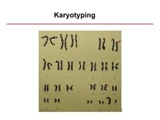 Karyotyping
 