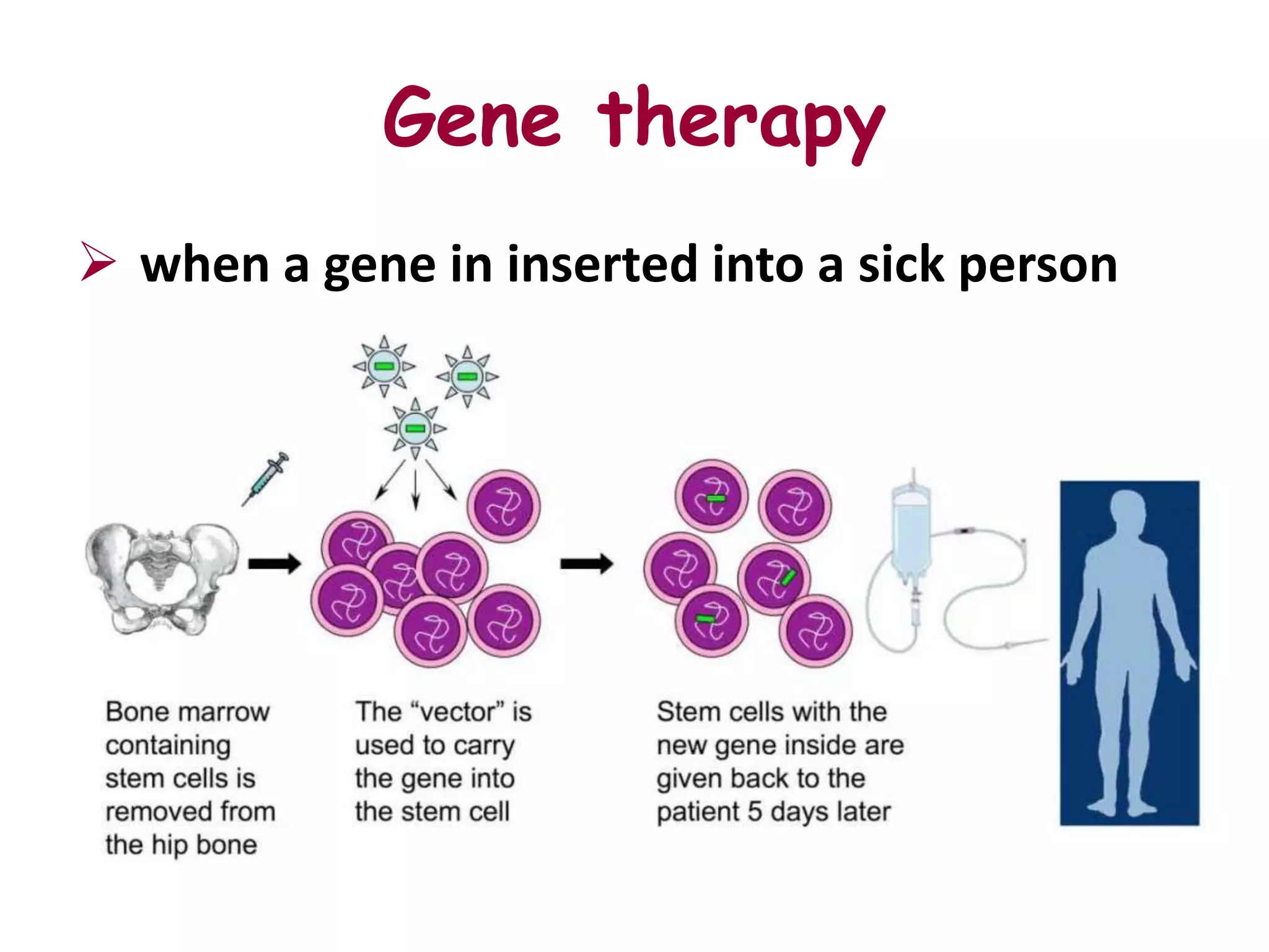 Gene therapy
 when a gene in inserted into a sick person
 