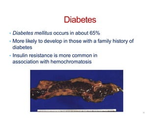 Diabetes
• Diabetes mellitus occurs in about 65%
• More likely to develop in those with a family history of
diabetes
• Insulin resistance is more common in
association with hemochromatosis
16
 