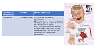 CHROMOSOME
ABNORMALITY
SYNONYM SKIN MANIFESTATION
TRISOMY 21 DOWN SYNDROME 1-10 year: dry skin, xerosis,
lichenification
10+ year: increased frequency of atopic
dermatitis, alopecia areata
Other associations: delayed dentition
and hypoplastic teeth, acrocyanosis,
livedo reticularis, cutis marmorata,
calcinosis cutis, palmoplantar
keratoderma
 