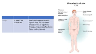 47XXY KLINEFELTER
SYNDROME
May develop gynecomastia
Sparse body and facial hair
Increased risk of leg ulcers
Increased incidence of systemic
lupus erythematosus
 