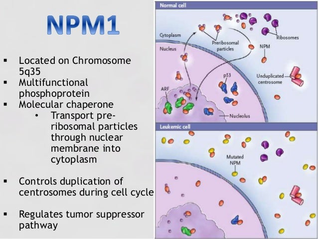 Genetic Markers In Aml Genetic Markers In Aml
