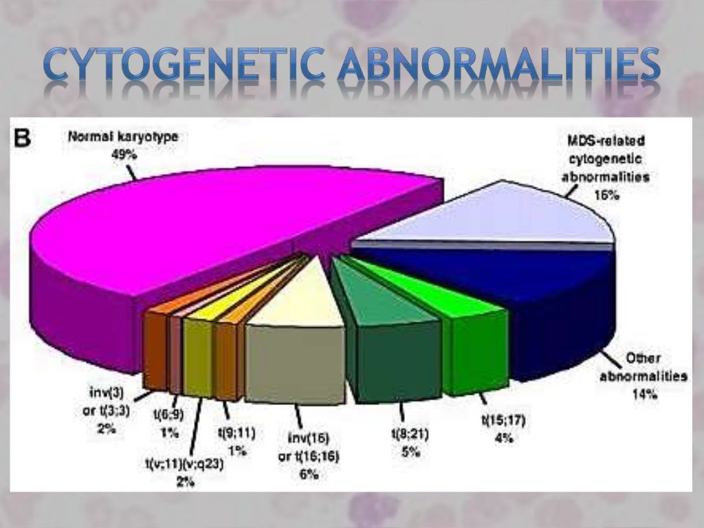 Genetic Markers In Aml Genetic Markers In Aml