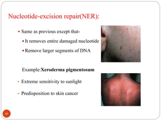 Nucleotide-excision repair(NER):
 Same as previous except that-
 It removes entire damaged nucleotide
 Remove larger segments of DNA
Example:Xeroderma pigmentosum
• Extreme sensitivity to sunlight
• Predisposition to skin cancer
50
 