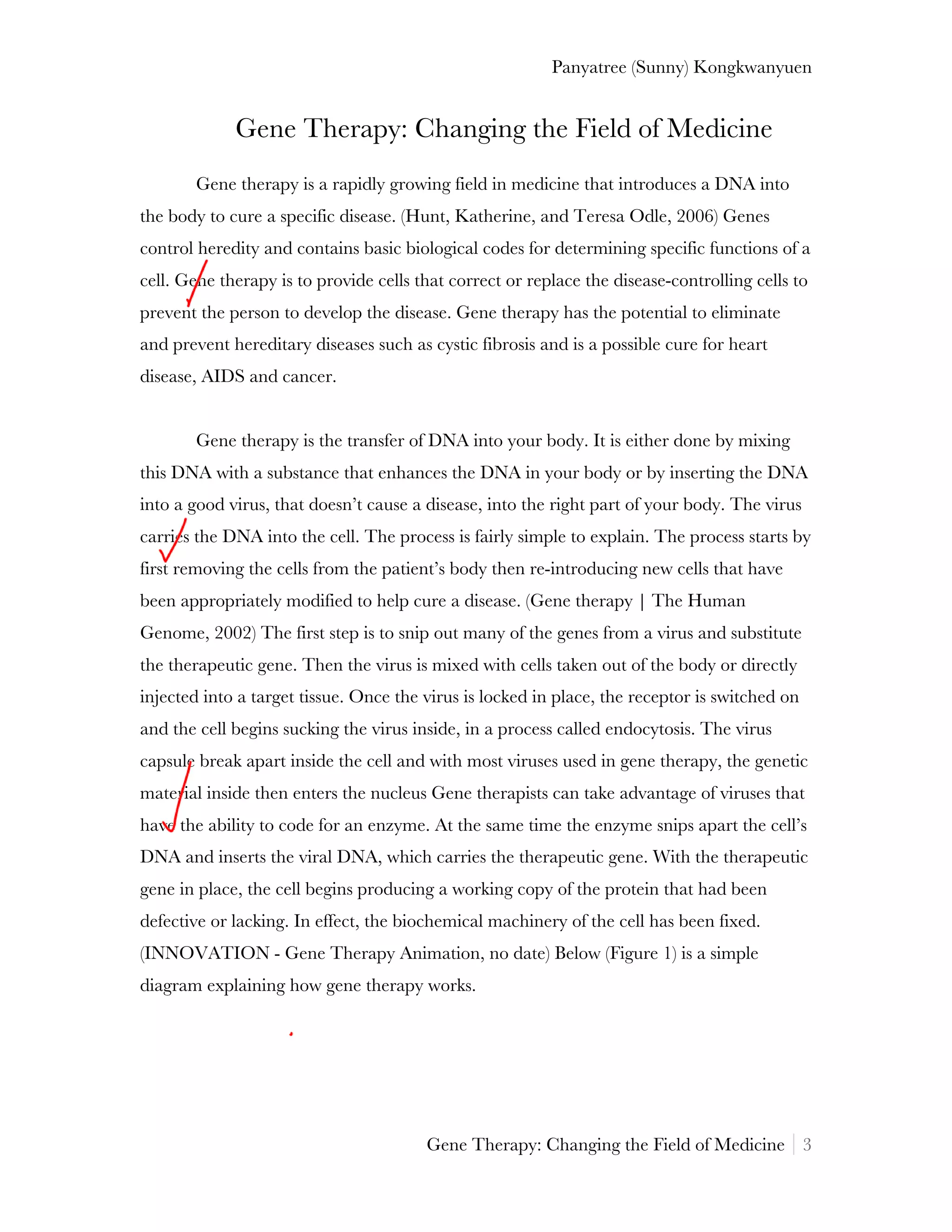 Panyatree (Sunny) Kongkwanyuen


             Gene Therapy: Changing the Field of Medicine
       Gene therapy is a rapidly growing field in medicine that introduces a DNA into
the body to cure a specific disease. (Hunt, Katherine, and Teresa Odle, 2006) Genes
control heredity and contains basic biological codes for determining specific functions of a
cell. Gene therapy is to provide cells that correct or replace the disease-controlling cells to
prevent the person to develop the disease. Gene therapy has the potential to eliminate
and prevent hereditary diseases such as cystic fibrosis and is a possible cure for heart
disease, AIDS and cancer.


       Gene therapy is the transfer of DNA into your body. It is either done by mixing
this DNA with a substance that enhances the DNA in your body or by inserting the DNA
into a good virus, that doesn’t cause a disease, into the right part of your body. The virus
carries the DNA into the cell. The process is fairly simple to explain. The process starts by
first removing the cells from the patient’s body then re-introducing new cells that have
been appropriately modified to help cure a disease. (Gene therapy | The Human
Genome, 2002) The first step is to snip out many of the genes from a virus and substitute
the therapeutic gene. Then the virus is mixed with cells taken out of the body or directly
injected into a target tissue. Once the virus is locked in place, the receptor is switched on
and the cell begins sucking the virus inside, in a process called endocytosis. The virus
capsule break apart inside the cell and with most viruses used in gene therapy, the genetic
material inside then enters the nucleus Gene therapists can take advantage of viruses that
have the ability to code for an enzyme. At the same time the enzyme snips apart the cell’s
DNA and inserts the viral DNA, which carries the therapeutic gene. With the therapeutic
gene in place, the cell begins producing a working copy of the protein that had been
defective or lacking. In effect, the biochemical machinery of the cell has been fixed.
(INNOVATION - Gene Therapy Animation, no date) Below (Figure 1) is a simple
diagram explaining how gene therapy works.




                                        Gene Therapy: Changing the Field of Medicine 3
 
