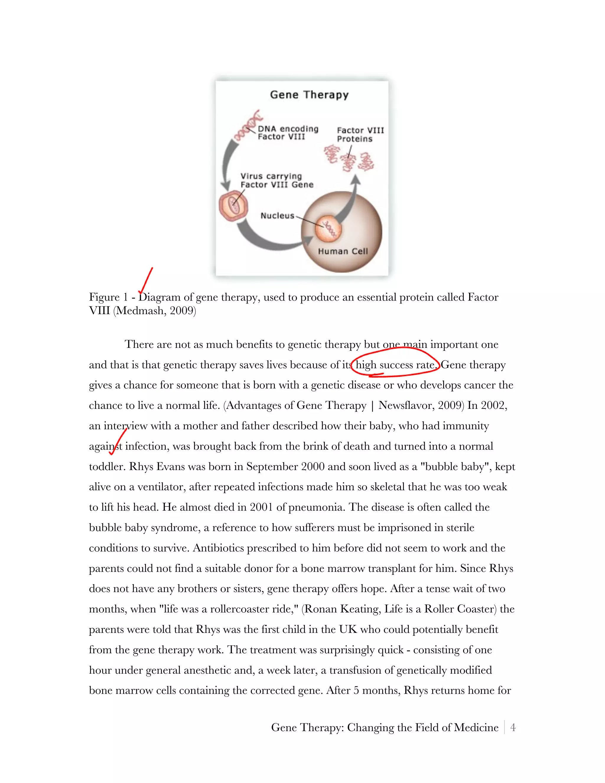 Figure 1 - Diagram of gene therapy, used to produce an essential protein called Factor
VIII (Medmash, 2009)

       There are not as much benefits to genetic therapy but one main important one
and that is that genetic therapy saves lives because of its high success rate. Gene therapy
gives a chance for someone that is born with a genetic disease or who develops cancer the
chance to live a normal life. (Advantages of Gene Therapy | Newsflavor, 2009) In 2002,
an interview with a mother and father described how their baby, who had immunity
against infection, was brought back from the brink of death and turned into a normal
toddler. Rhys Evans was born in September 2000 and soon lived as a "bubble baby", kept
alive on a ventilator, after repeated infections made him so skeletal that he was too weak
to lift his head. He almost died in 2001 of pneumonia. The disease is often called the
bubble baby syndrome, a reference to how sufferers must be imprisoned in sterile
conditions to survive. Antibiotics prescribed to him before did not seem to work and the
parents could not find a suitable donor for a bone marrow transplant for him. Since Rhys
does not have any brothers or sisters, gene therapy offers hope. After a tense wait of two
months, when "life was a rollercoaster ride," (Ronan Keating, Life is a Roller Coaster) the
parents were told that Rhys was the first child in the UK who could potentially benefit
from the gene therapy work. The treatment was surprisingly quick - consisting of one
hour under general anesthetic and, a week later, a transfusion of genetically modified
bone marrow cells containing the corrected gene. After 5 months, Rhys returns home for


                                       Gene Therapy: Changing the Field of Medicine 4
 