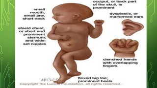 Genetic pattern of common pediatric disorder | PPTX