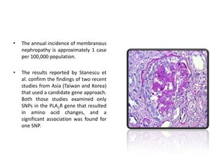 The annual incidence of membranous nephropathy is approximately 1 case per 100,000 population.The results reported by Stanescu et al. confirm the findings of two recent studies from Asia (Taiwan and Korea) that used a candidate gene approach. Both those studies examined only SNPs in the PLA2R gene that resulted in amino acid changes, and a significant association was found for one SNP.