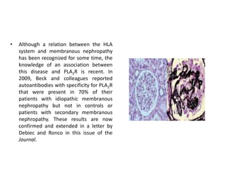 Although a relation between the HLA system and membranous nephropathy has been recognized for some time, the knowledge of an association between this disease and PLA2R is recent. In 2009, Beck and colleagues reported autoantibodies with specificity for PLA2R that were present in 70% of their patients with idiopathic membranous nephropathy but not in controls or patients with secondary membranous nephropathy. These results are now confirmed and extended in a letter by Debiec and Ronco in this issue of the Journal.