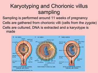 Karyotyping and Chorionic villus sampling Sampling is performed around 11 weeks of pregnancy Cells are gathered from chorionic villi (cells from the zygote) Cells are cultured, DNA is extracted and a karyotype is made 