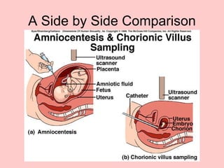 A Side by Side Comparison 