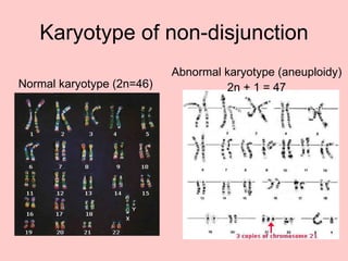 Karyotype of non-disjunction Normal karyotype (2n=46) Abnormal karyotype (aneuploidy) 2n + 1 = 47 