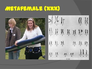 Metafemale (XXX)
 