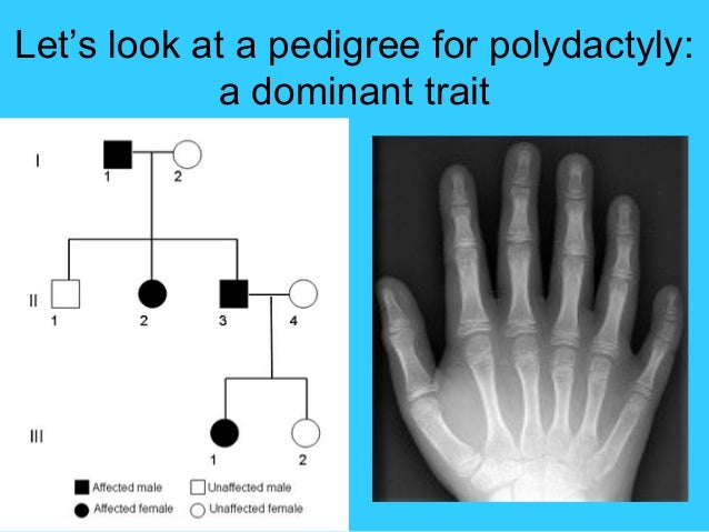 Polydactyly Pedigree Chart