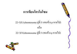 การเขียนโครโมโซม
22+XX (chromosome คู่ที 5 แขนข้าง p หายไป)
หรื อ
22+XY(chromosome คู่ที 5 แขนข้าง p หายไป)

 