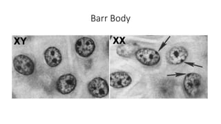 Barr Body
 